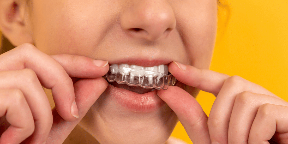 Orthodontics for All Ages: Addressing Adult Patients' Needs