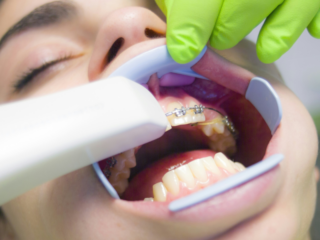4 Dental Problems That Arise From Not Flossing Your Teeth