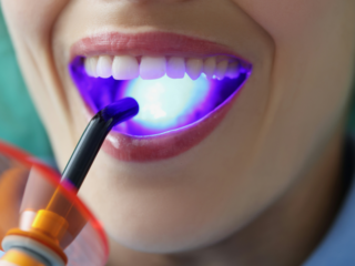 How Comprehensive Dental Benefits Enhance Employee Wellness