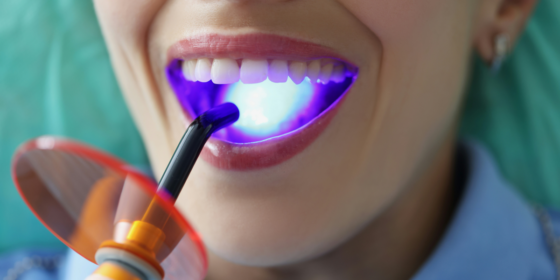 How Comprehensive Dental Benefits Enhance Employee Wellness