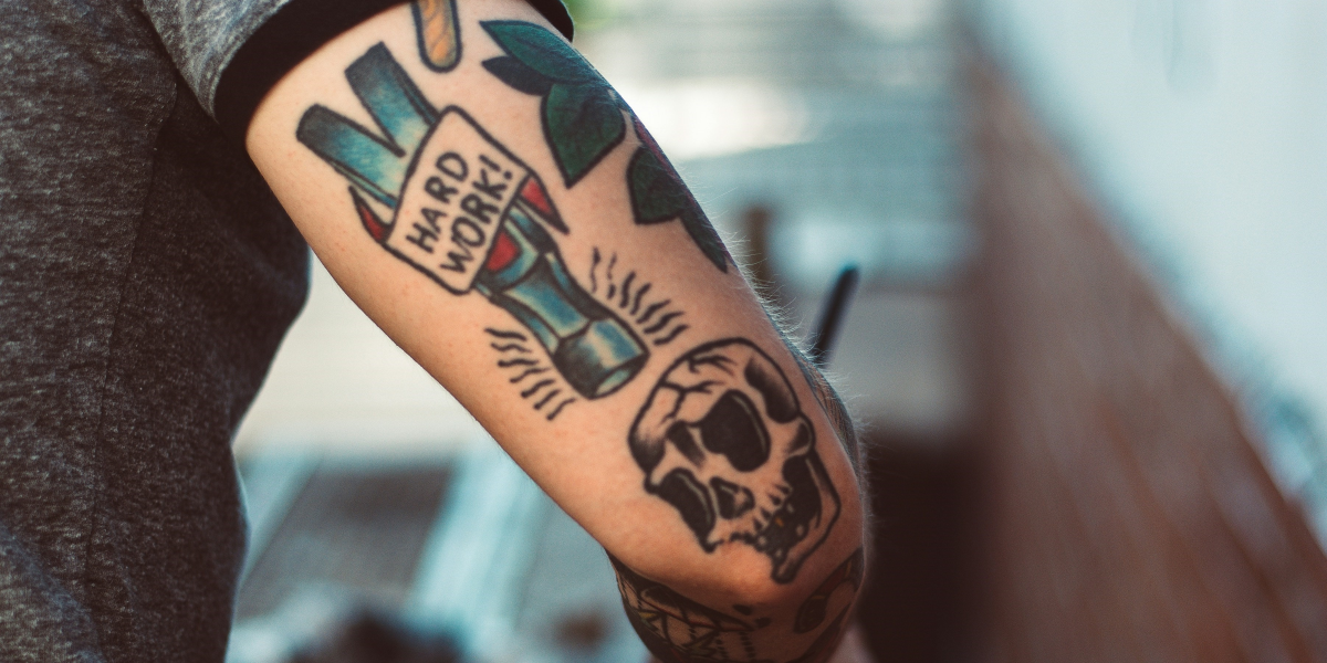 Factors to Consider Before Making the Decision to Remove a Tattoo