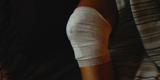 How Legal Funding Works for Injury Cases Today