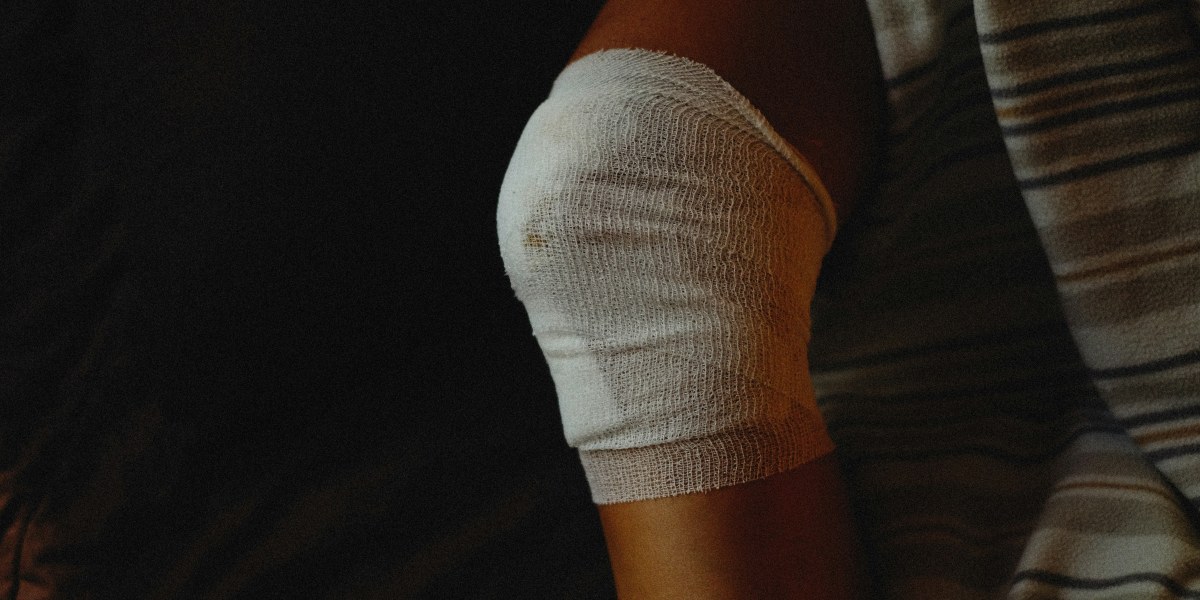 How Legal Funding Works for Injury Cases Today