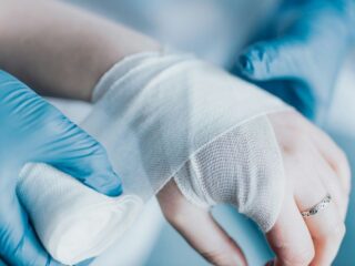 How Philadelphia Burn Injury Lawyers Help Injured Victims