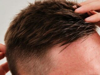What Is Hair Restoration Surgery? Costs, Process, and Results